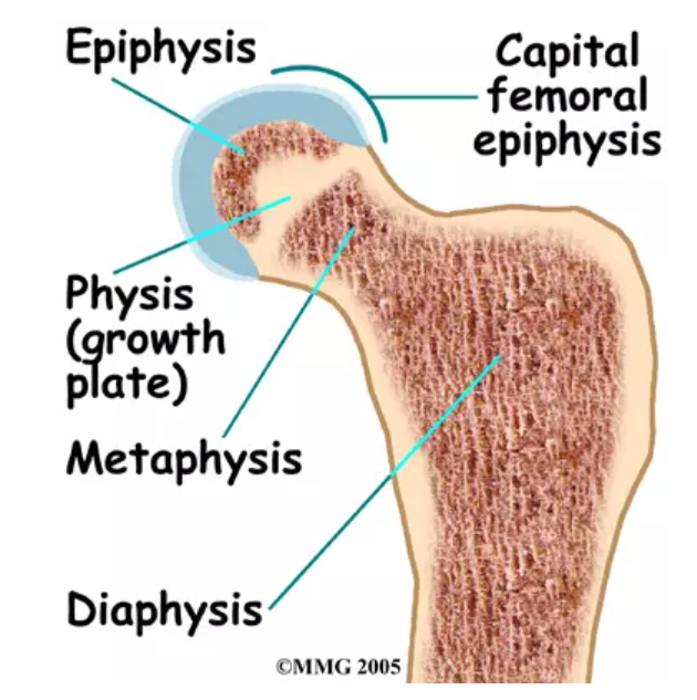 Slipped upper femoral epiphysis (SUFE)